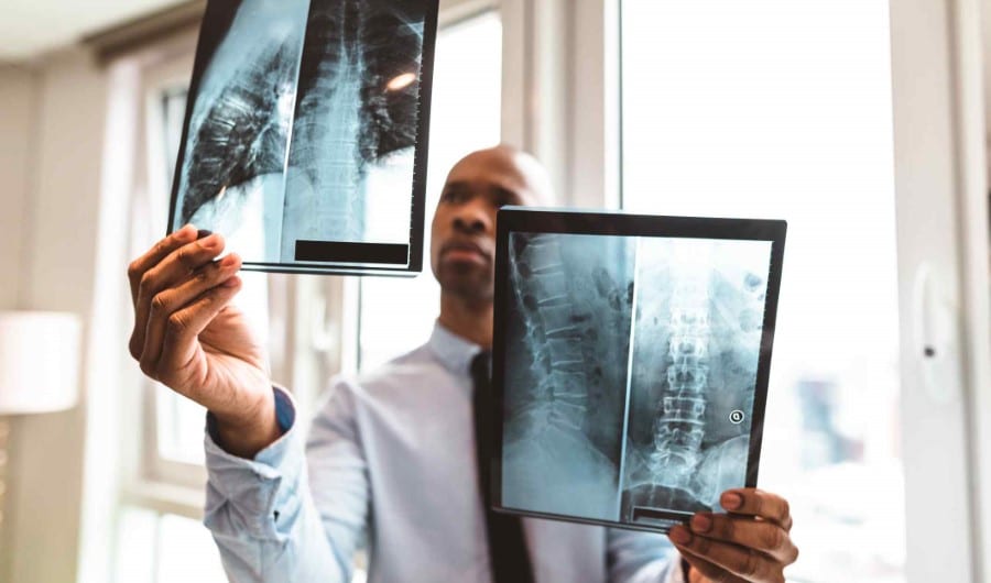 spinal-cord-injuries-common